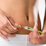 Embolisation Artérielle Bariatrique